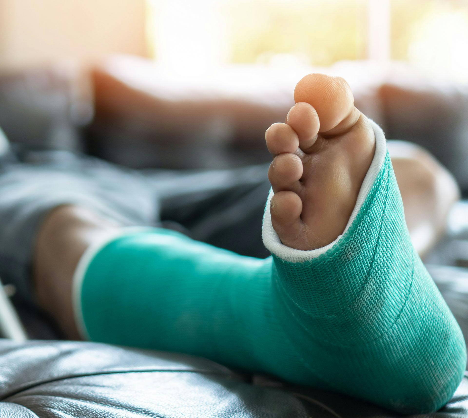 Foot in cast