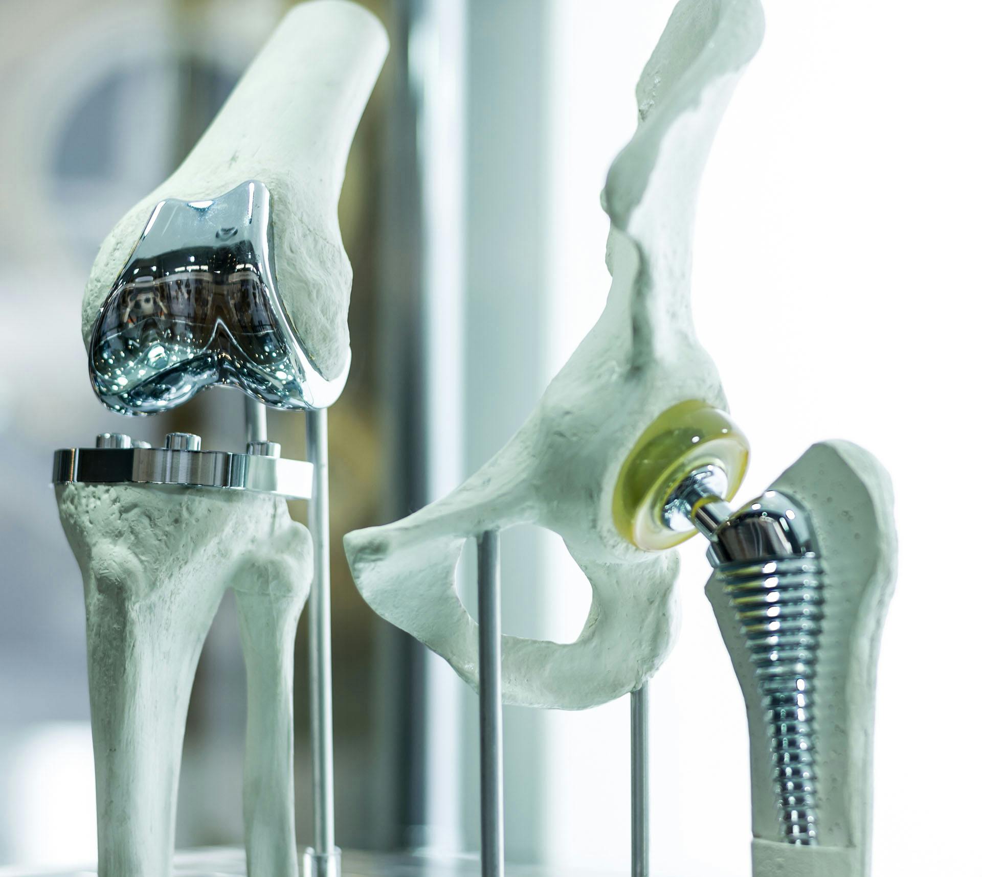 Prosthetic bones