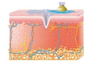 diagram of skin layers