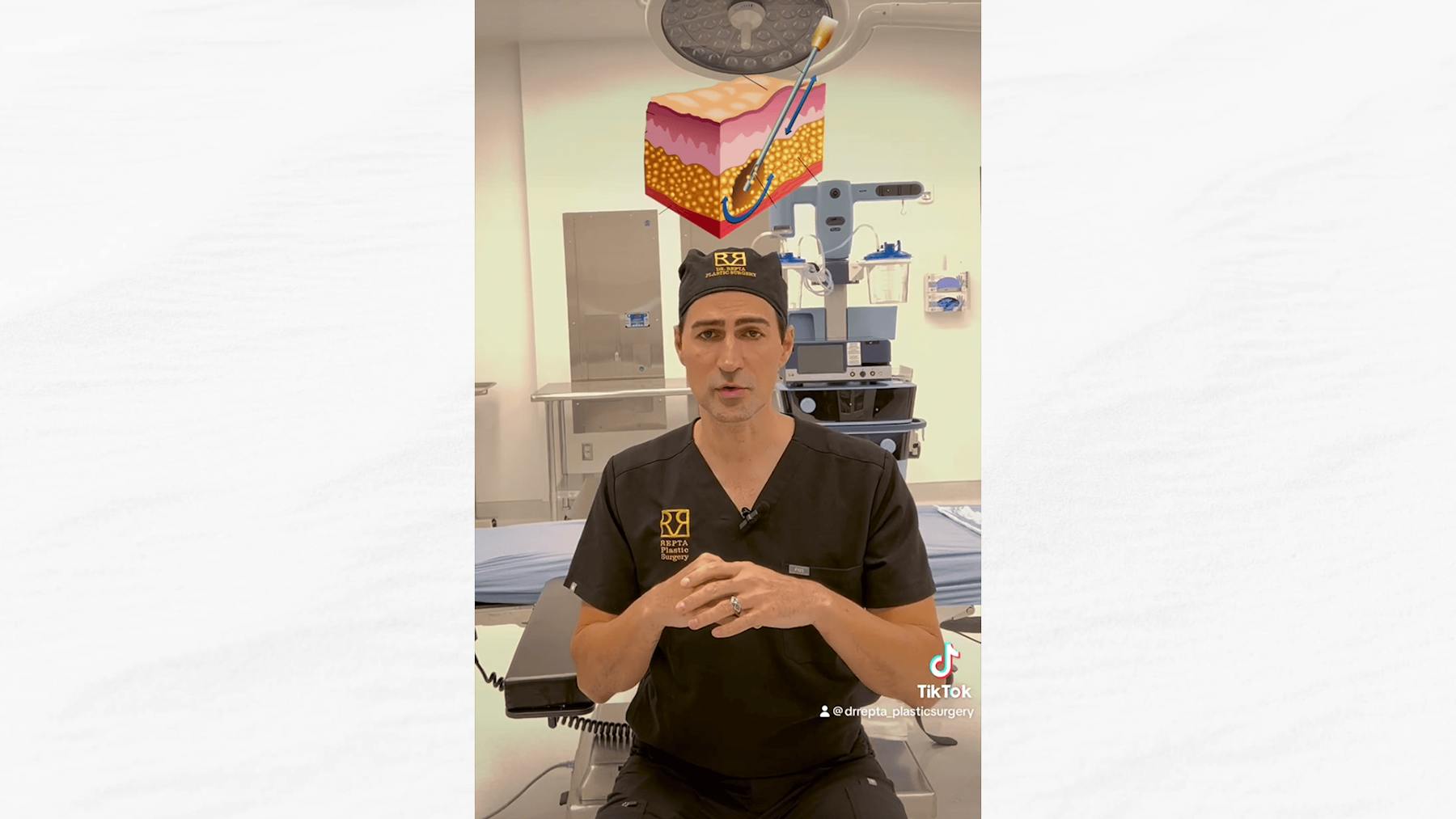 Plus Size Tummy Tuck