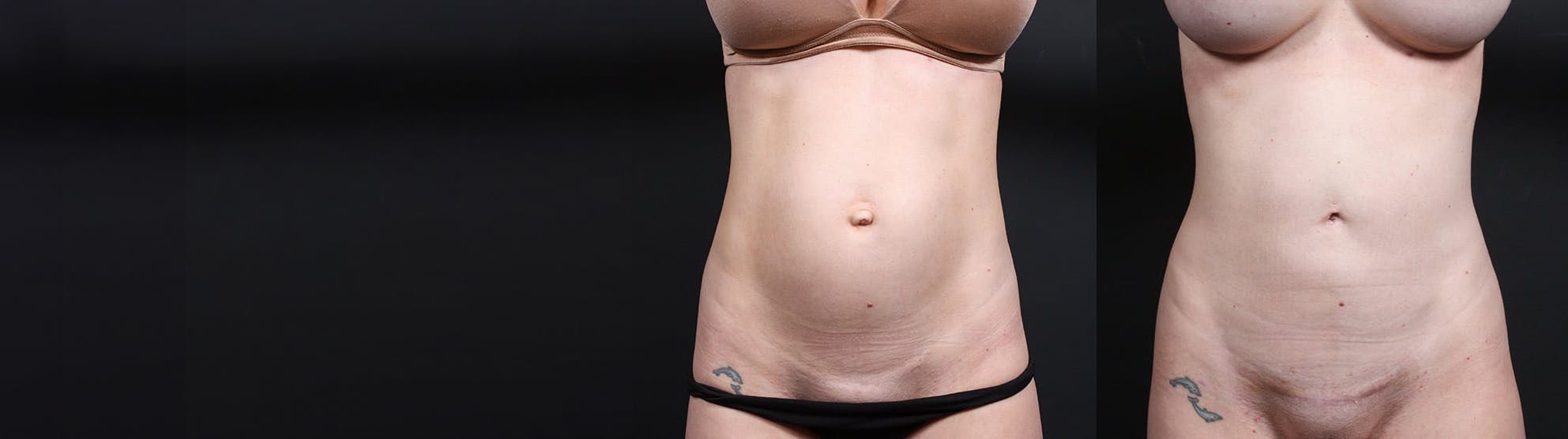 woman body with beige underwear on