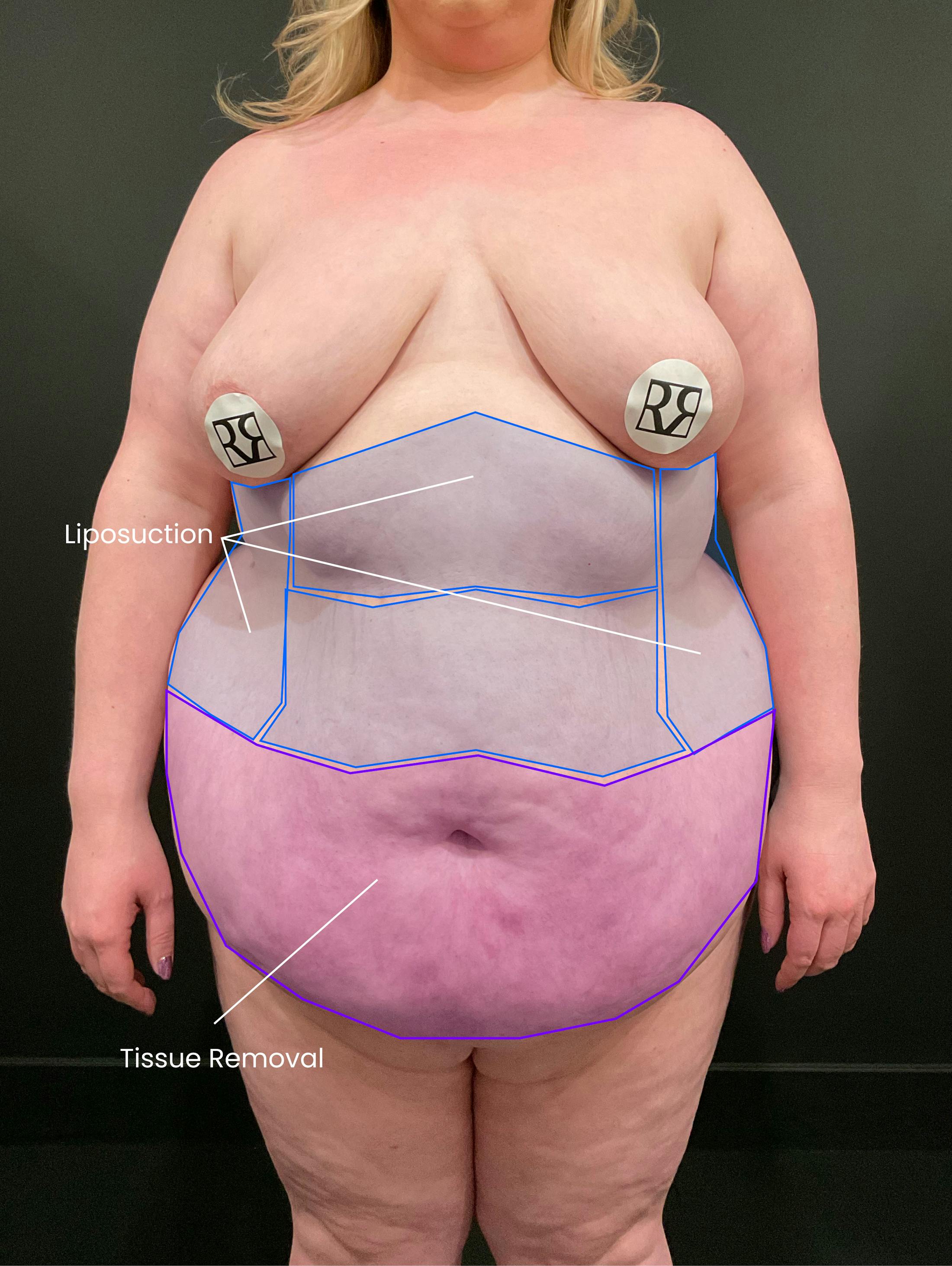 Patient D Before Photo