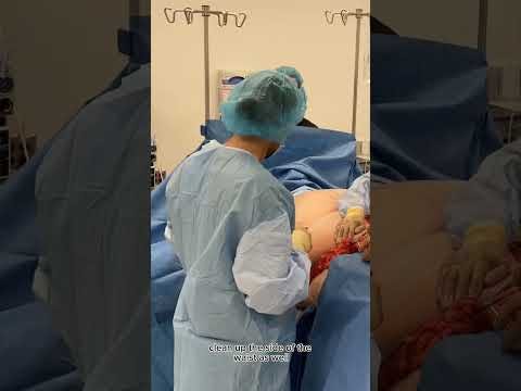 surgery in progress
