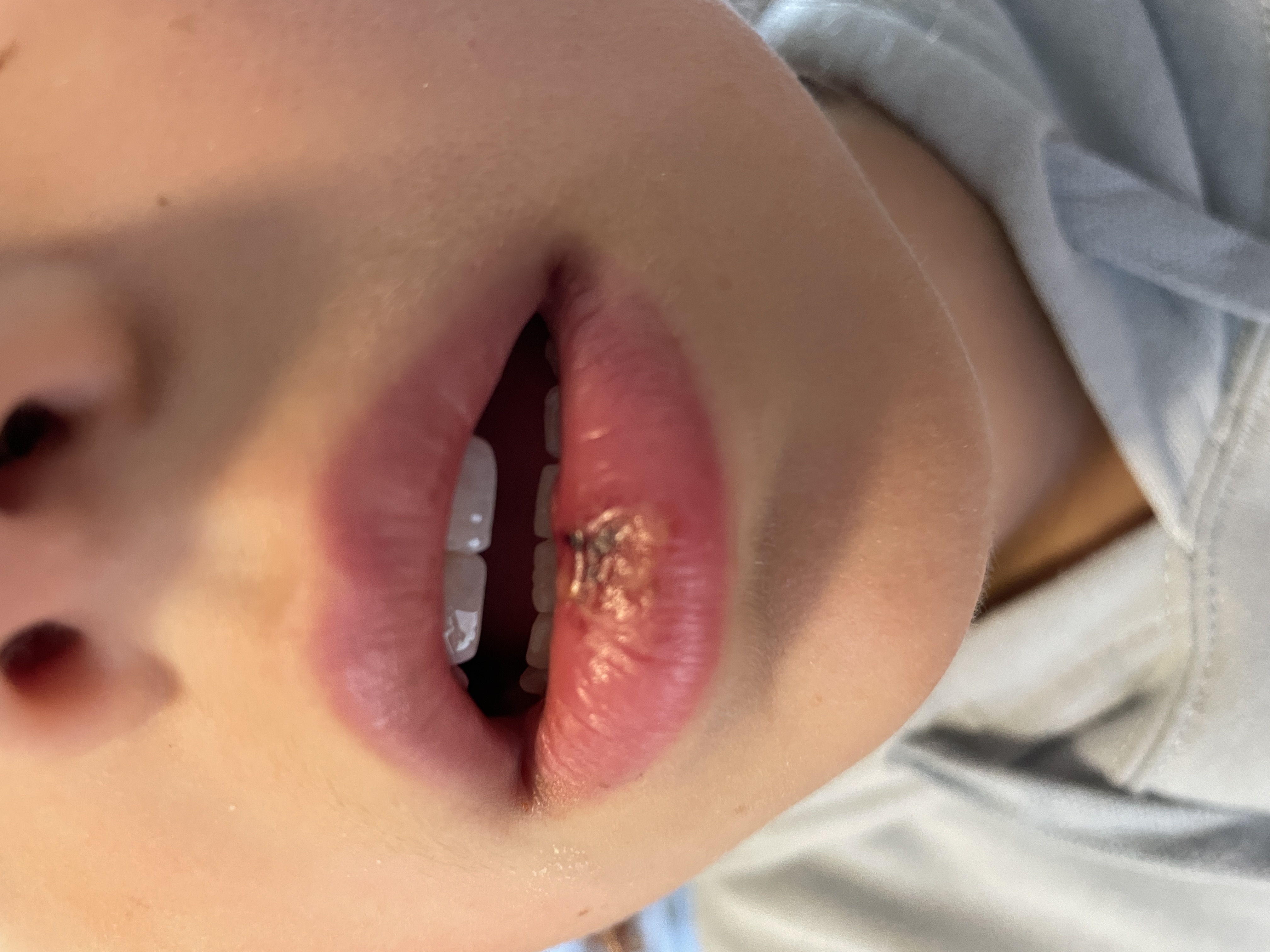 Img: body part, mouth, person, baby, medication, pill, face, head