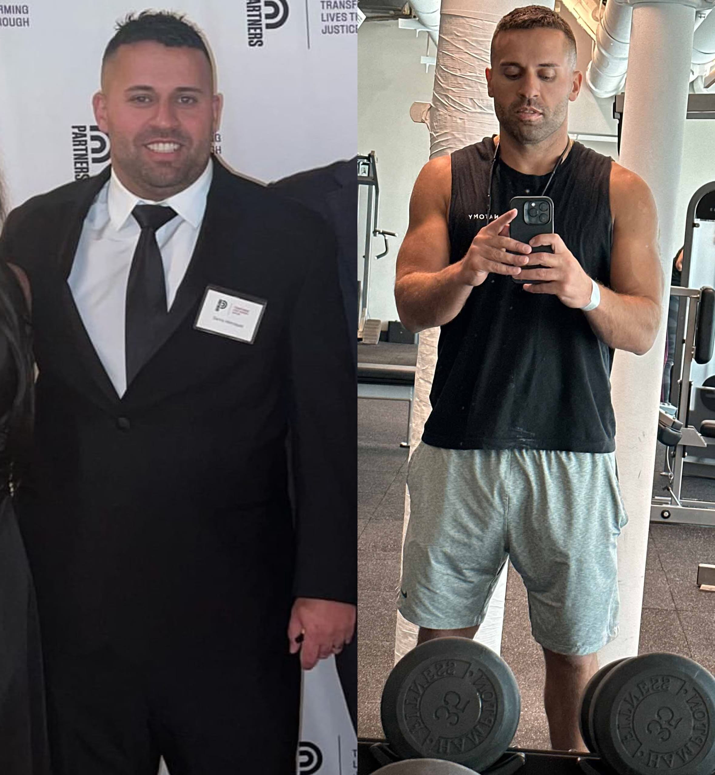 Weight Loss Before & After image