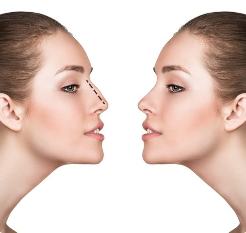 Nose Rhinoplasty 基本技術と臨床ケース Rhinoplasty Orange County | Nose Anatomy - Tip - Newport Beach