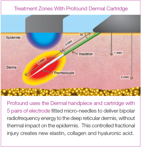 The Non-Surgical Facelift