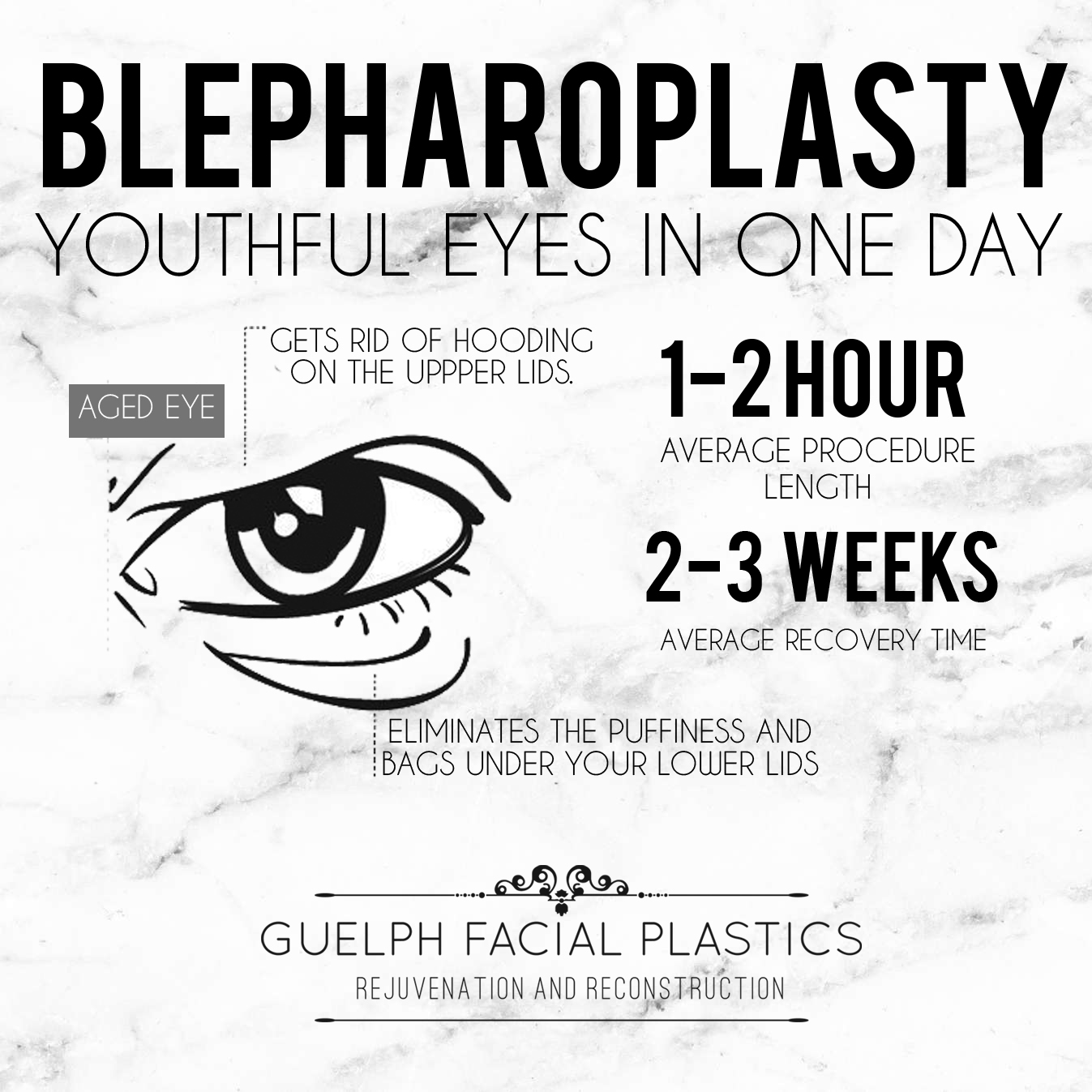 Achieving the Best Results After Eyelid Surgery Facial Plastics