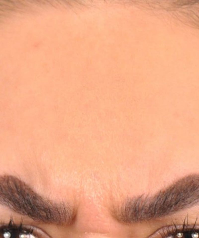 eyebrows down-before