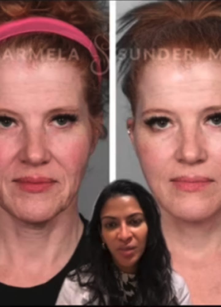 Sunder Plastic Surgery