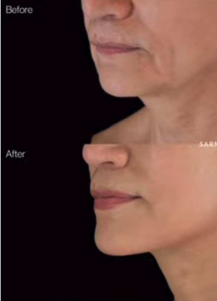 Sunder Plastic Surgery