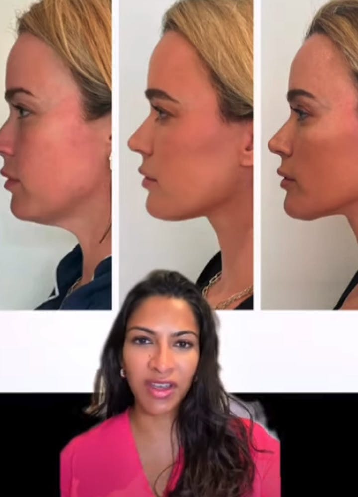 Sunder Plastic Surgery