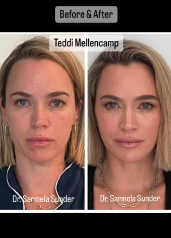 Sunder Plastic Surgery