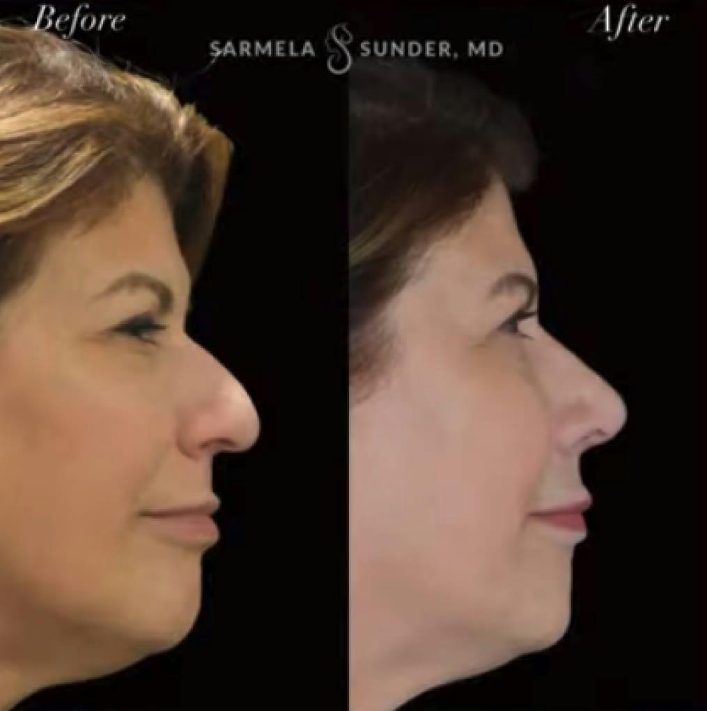 Sunder Plastic Surgery