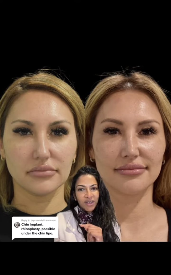 Sunder Plastic Surgery