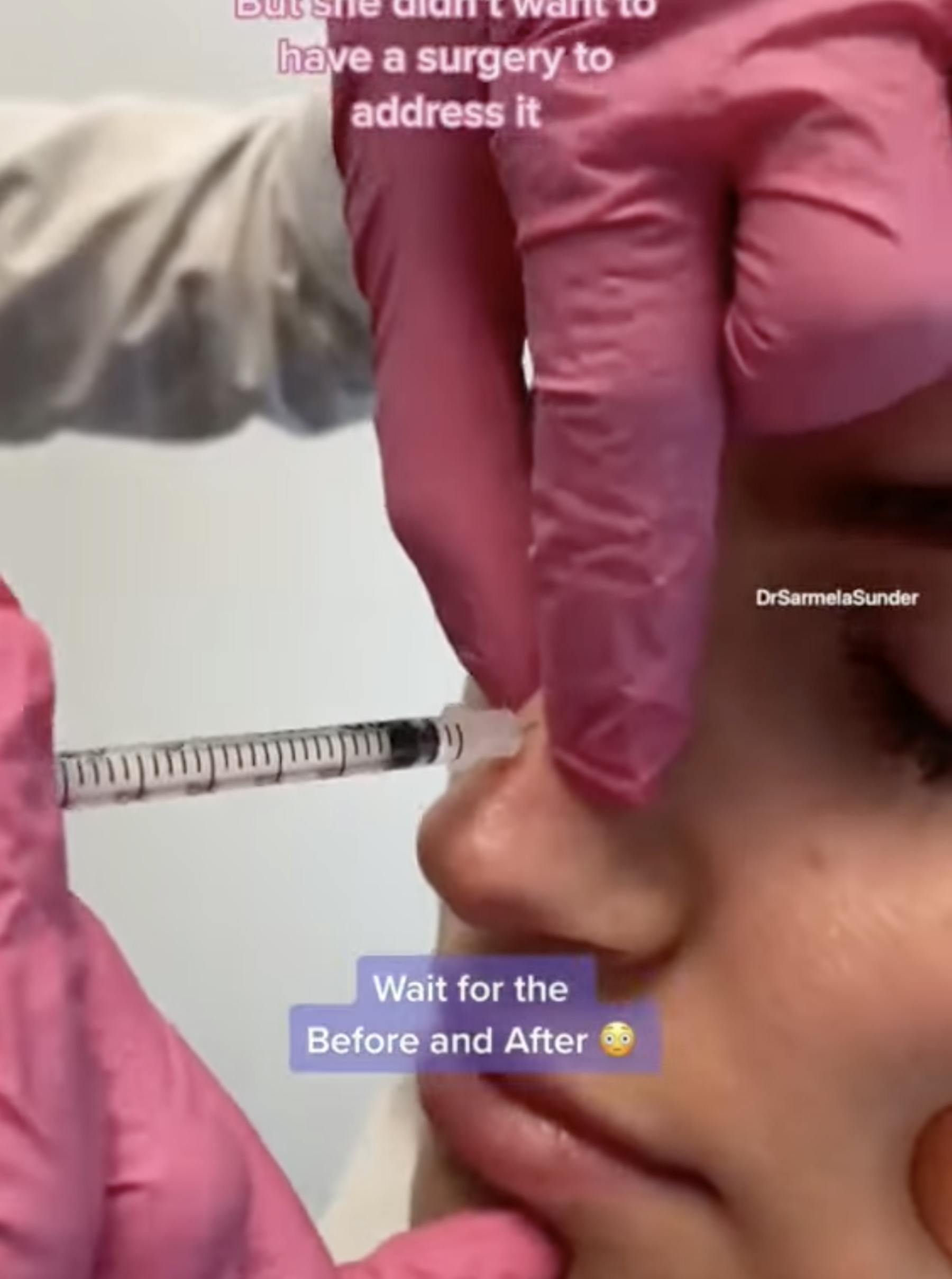 Sunder Plastic Surgery