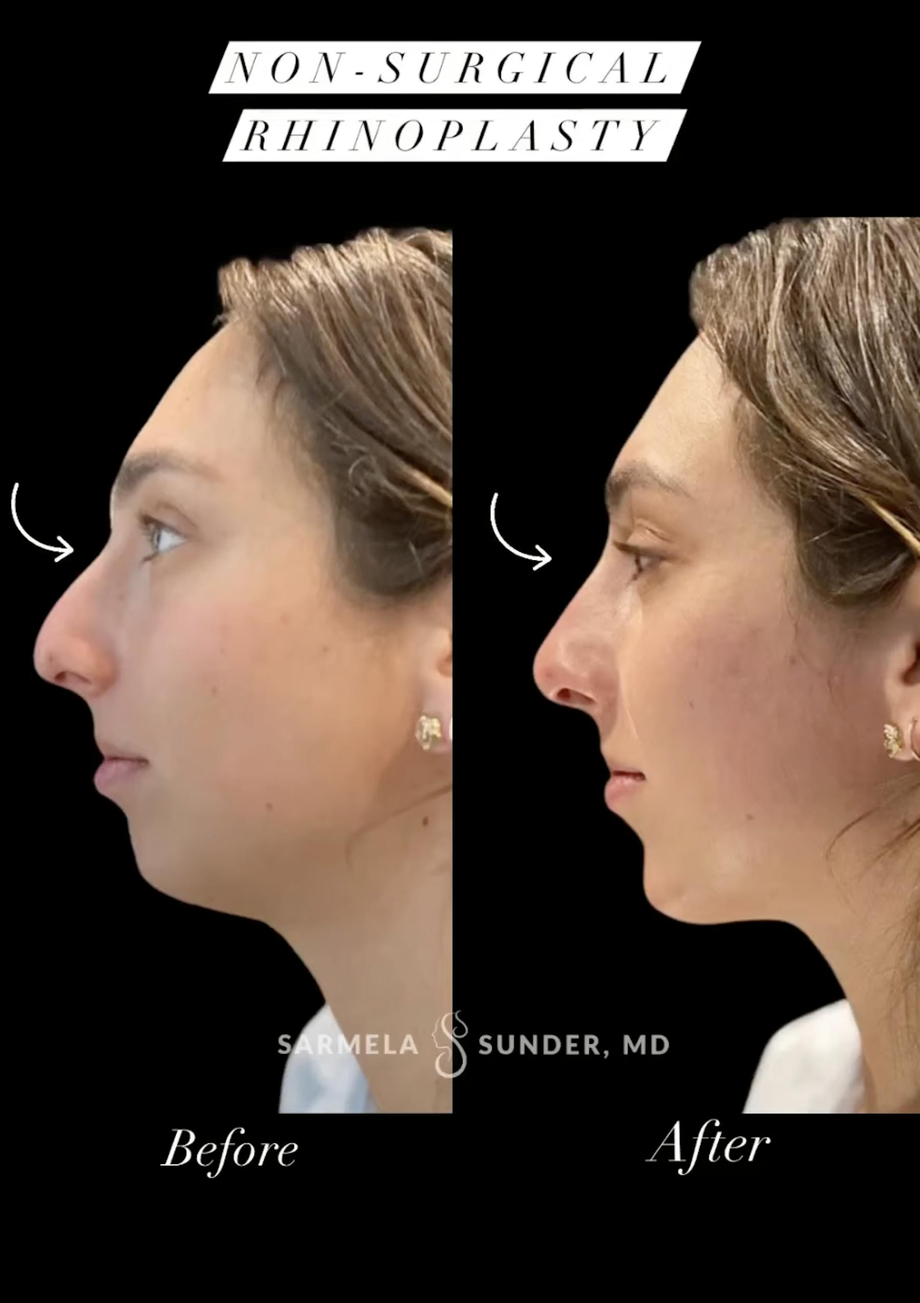 Sunder Plastic Surgery