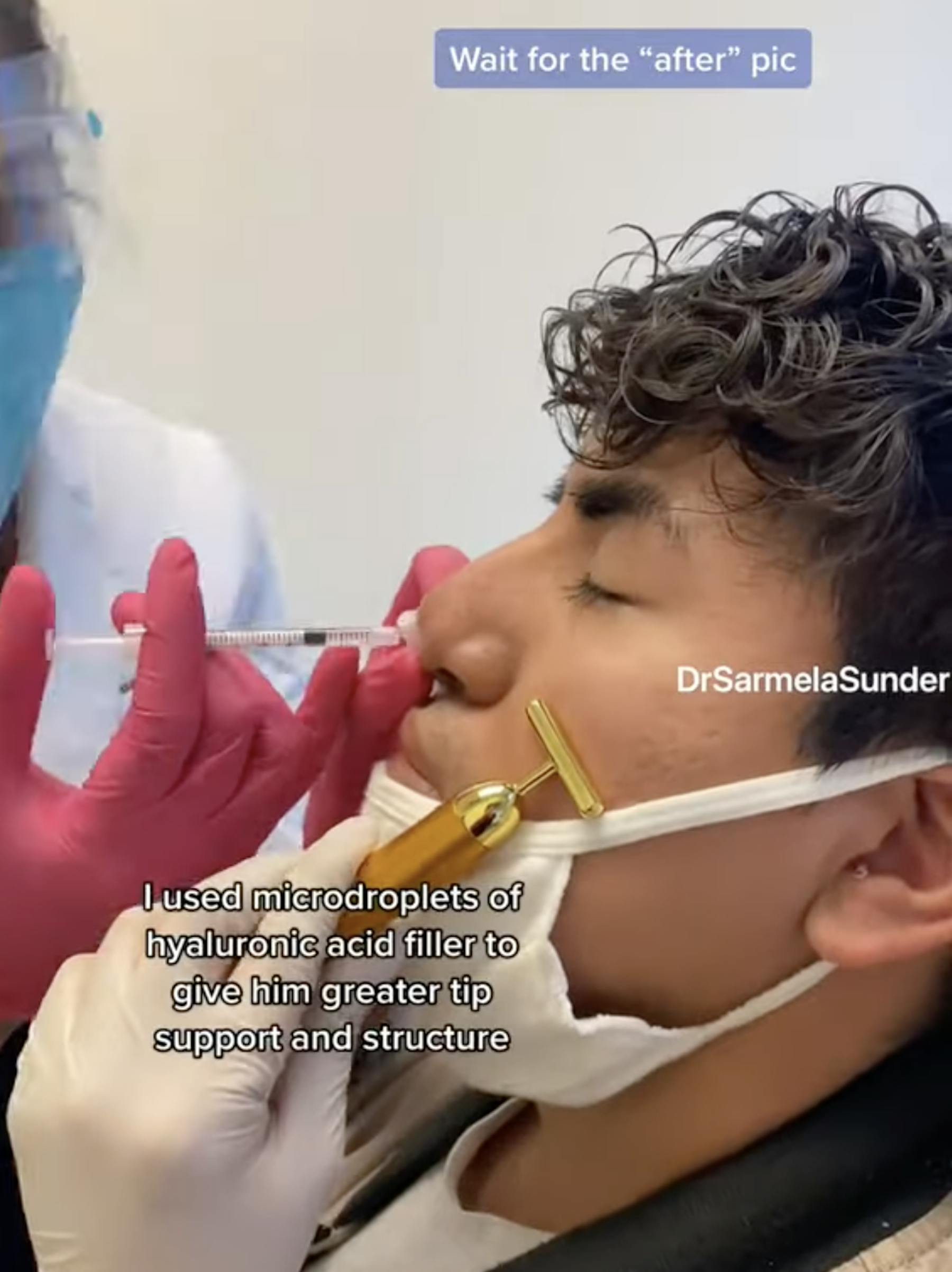 Sunder Plastic Surgery