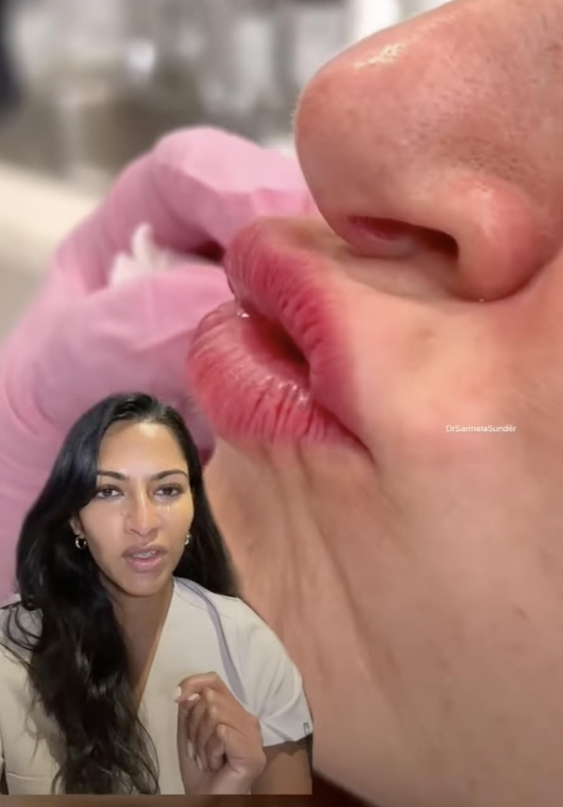 Sunder Plastic Surgery