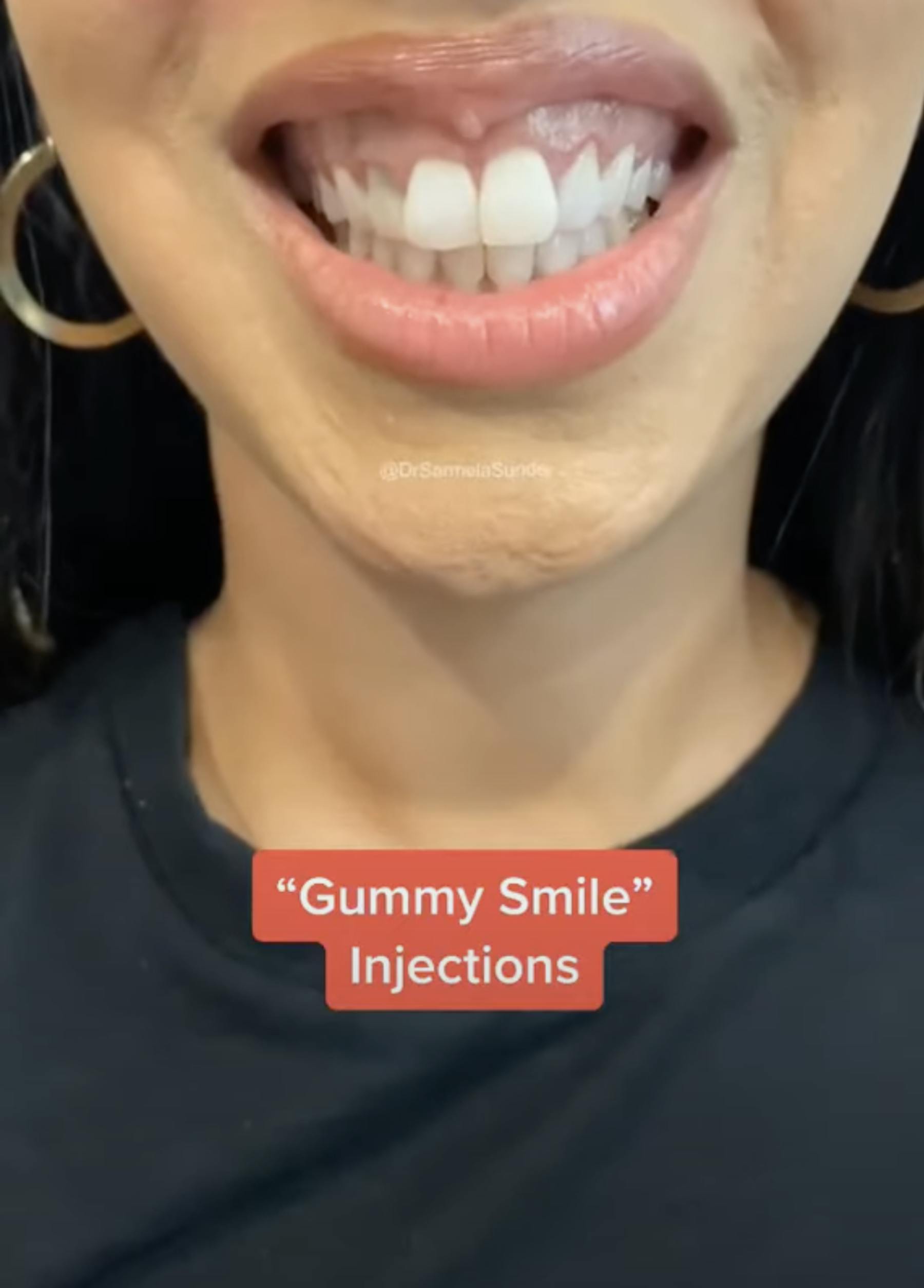 Sunder Plastic Surgery