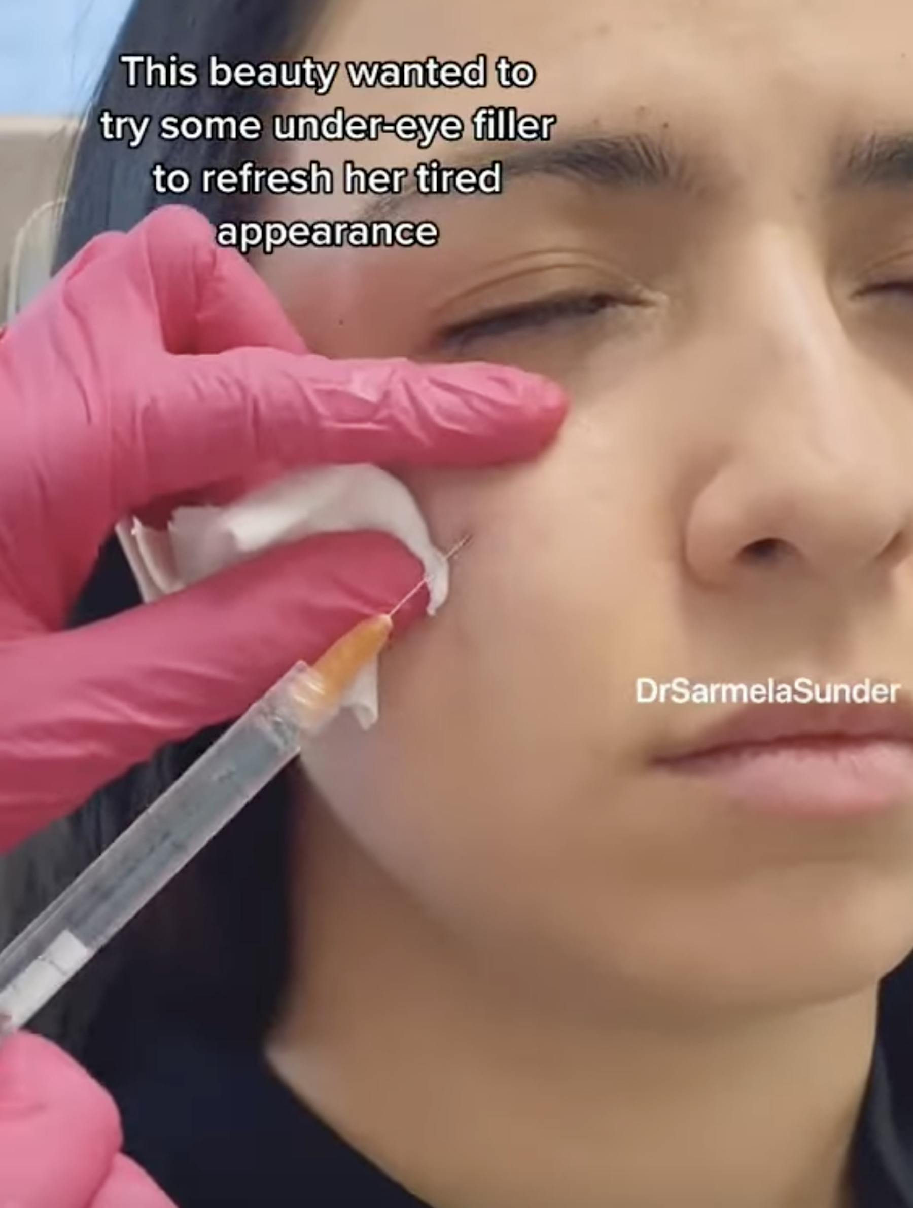 Sunder Plastic Surgery