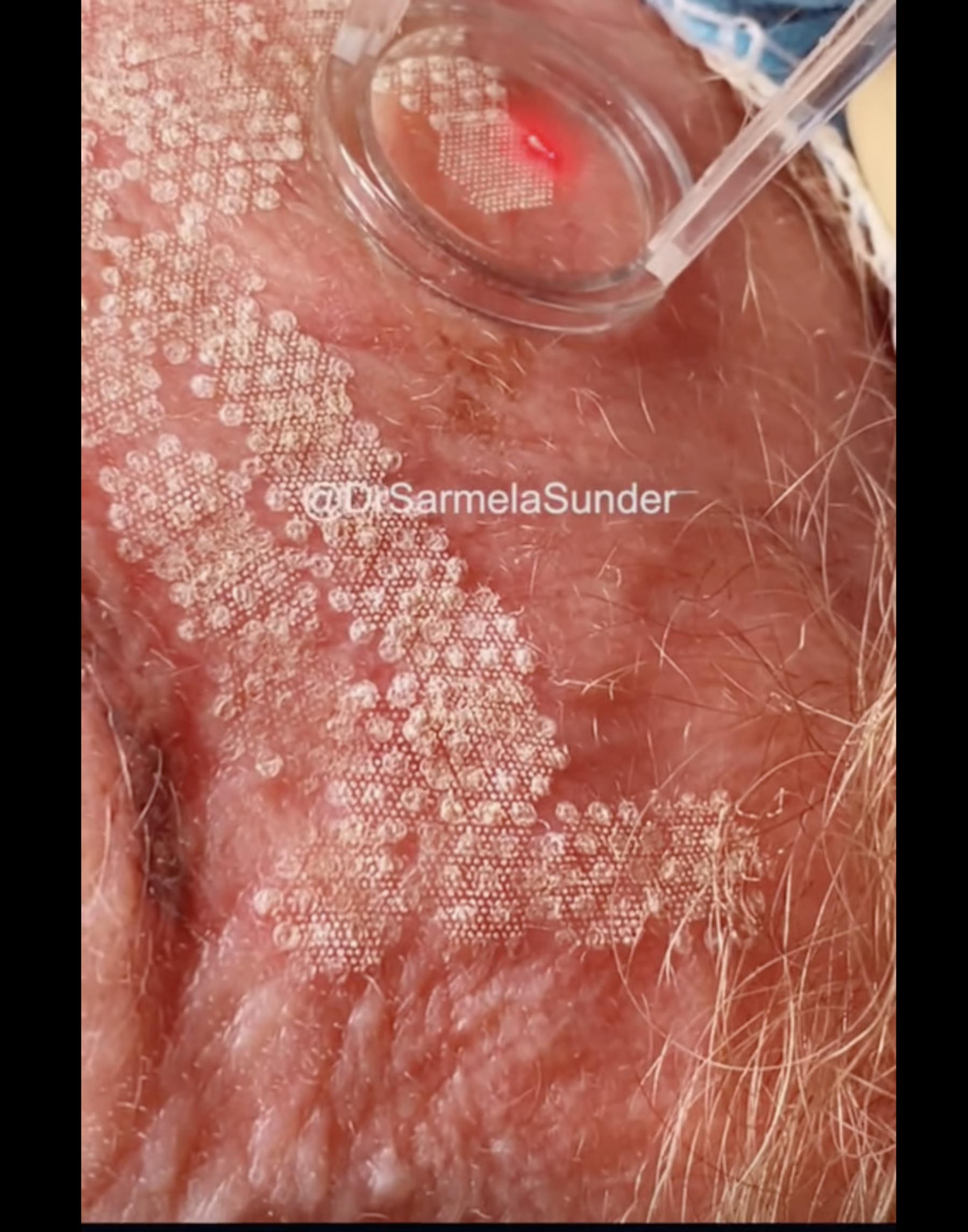 Sunder Plastic Surgery