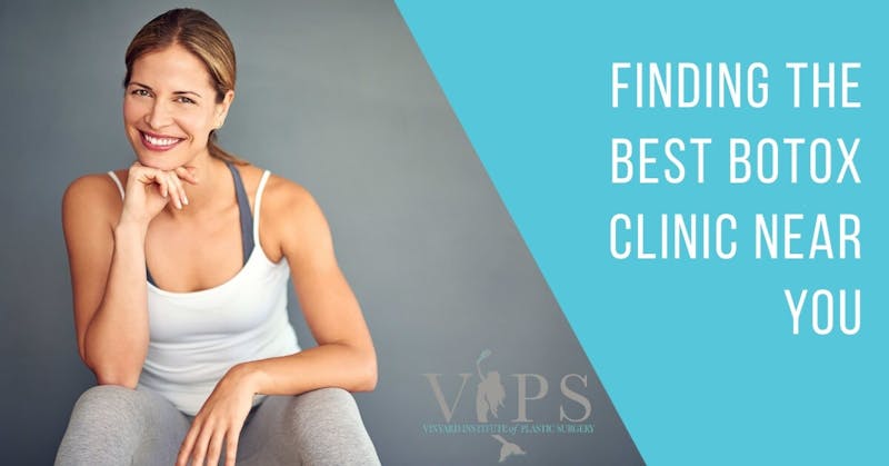 woman with chin resting on hand smiling