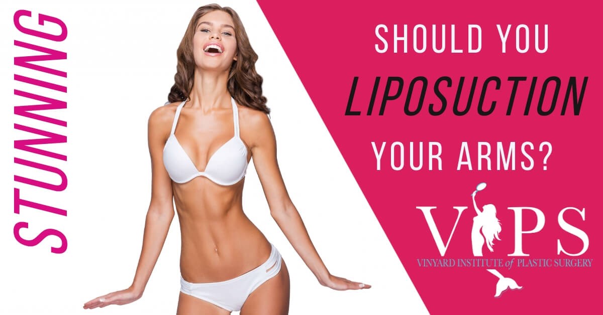 Tips and Tricks for a Successful Arm Lipo Recovery