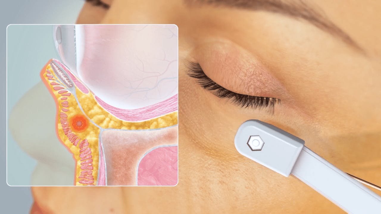 diagram of person's nose