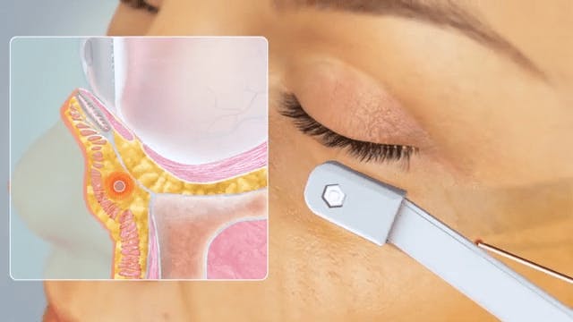 woman in a device under her eye and close up of an image of the womans internal workings