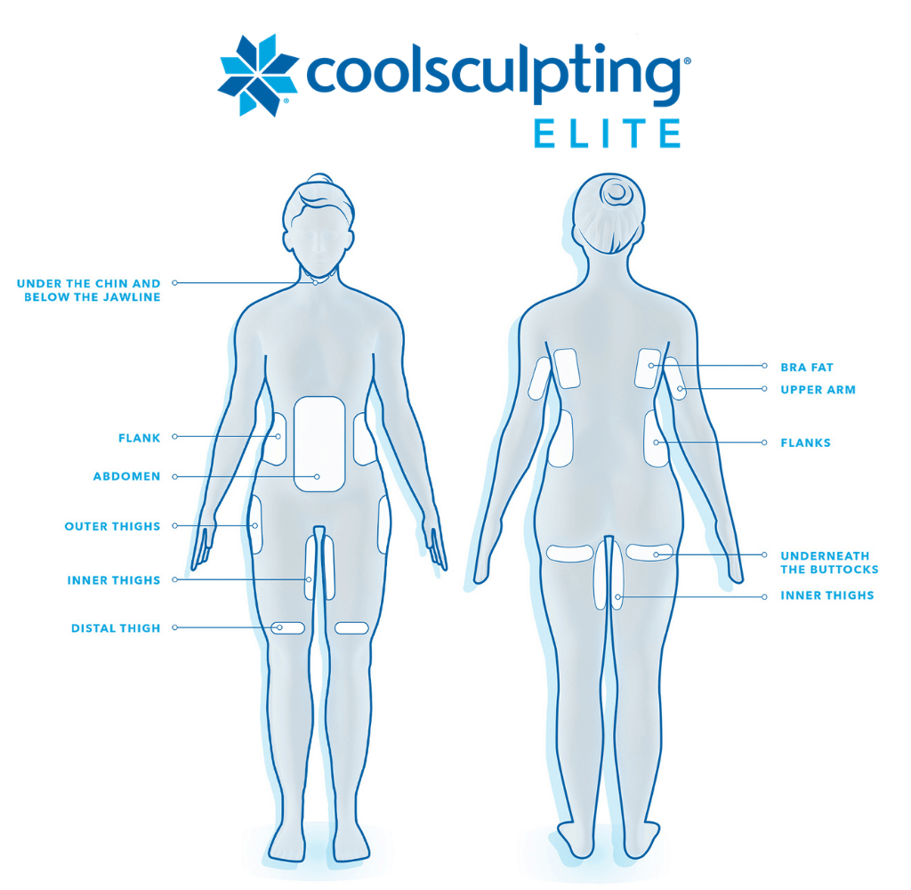 info graphic of coolsculpting elite places to get the procedure done