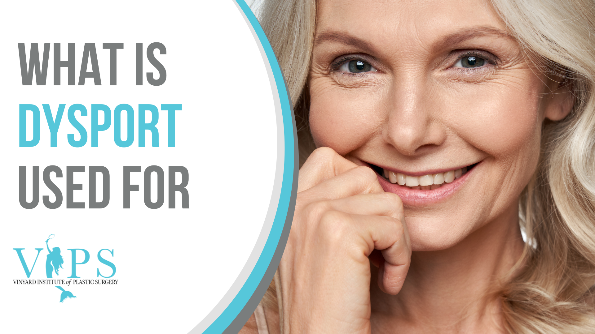 What Is Dysport Used For?