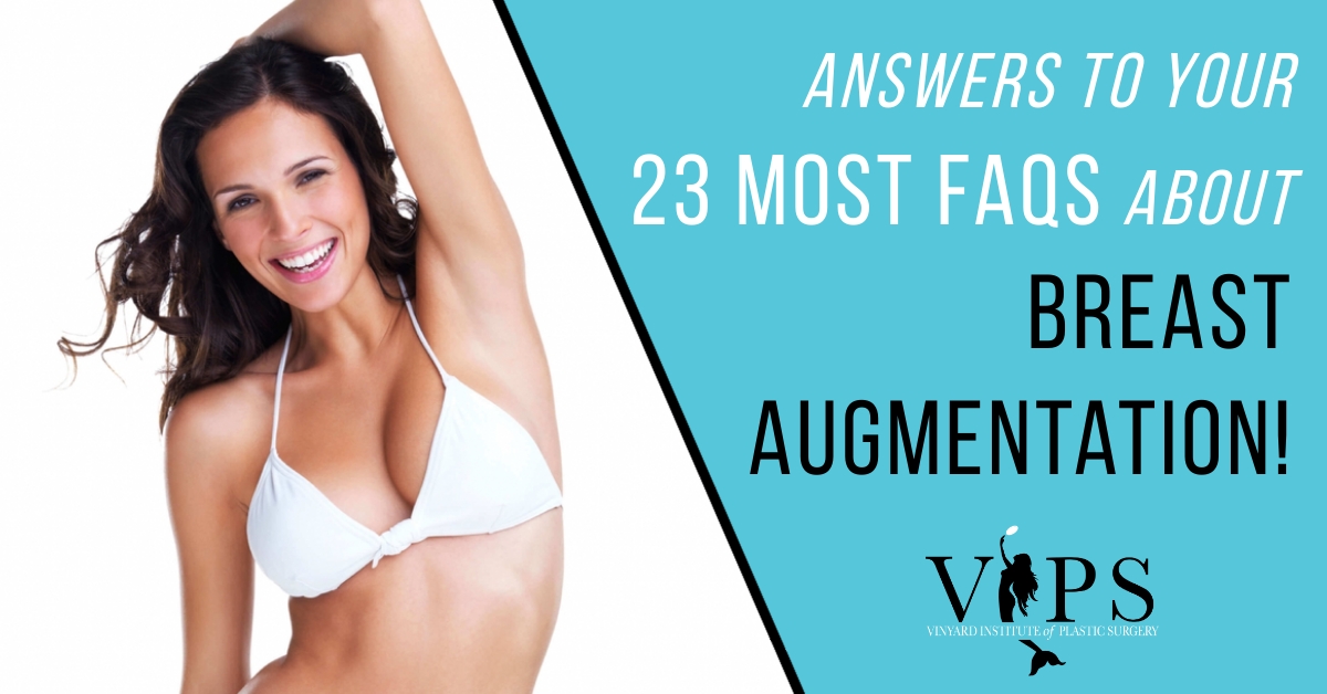 23 Most FAQs About Breast Augmentation: Part 1