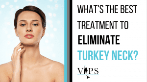 What's the Best Treatment to Eliminate My Turkey Neck