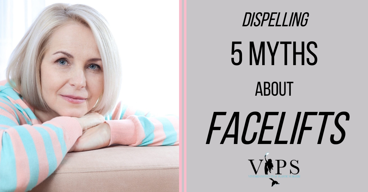 Dispelling 5 Myths About Facelifts
