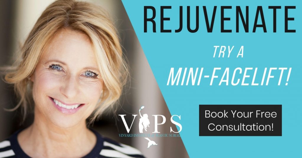 rejuvenate: try a mini-facelift