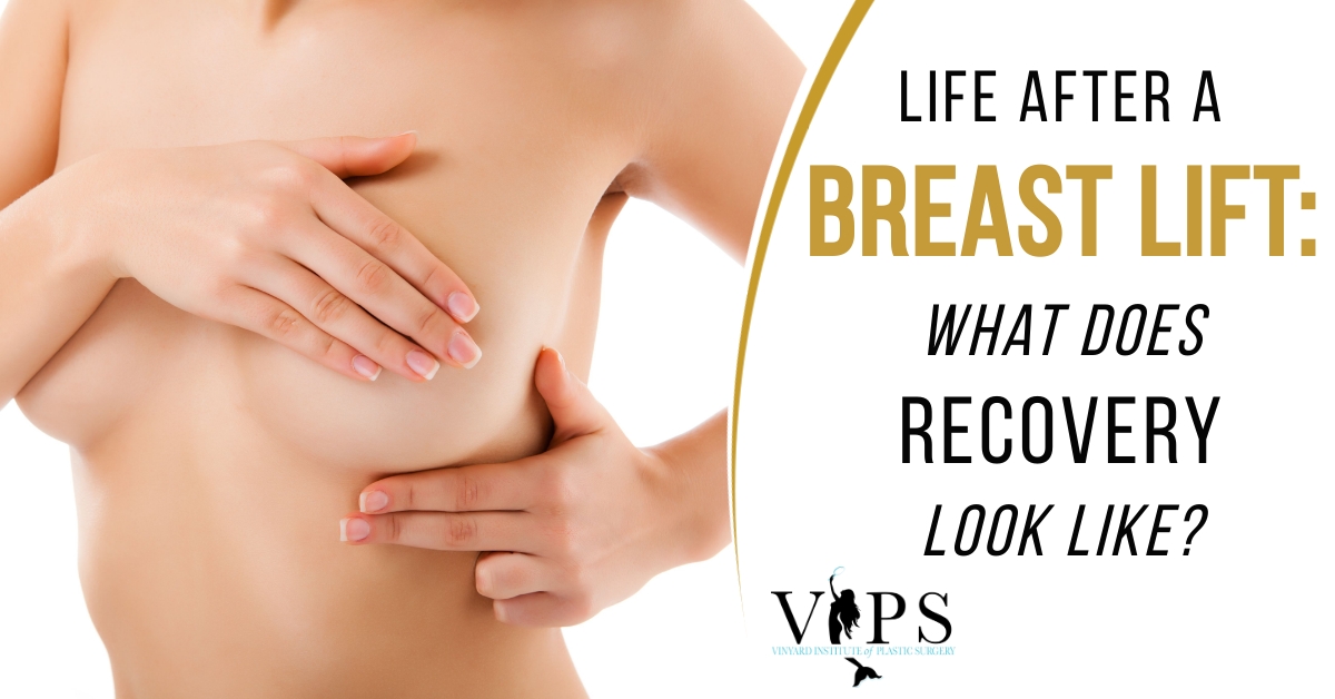 Breast Rejuvenation Options After Pregnancy and Breastfeeding