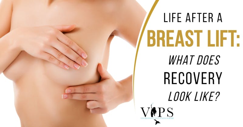 4 Ways Breast Lifts Differ From Breast Reduction