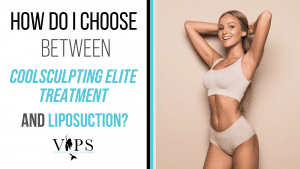 How Do I Choose Between CoolSculpting Elite Treatment And Liposuction