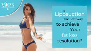 Is Liposuction the Best Way to Achieve Your Fat Loss Resolution?