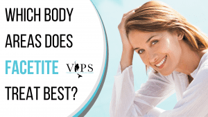 Which Body Areas Does FACEtite Treat Best