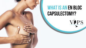 What is an en bloc capsulectomy?