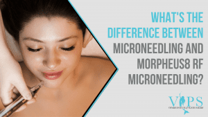 morpheus8 rf microneedling vs. traditional microneedling