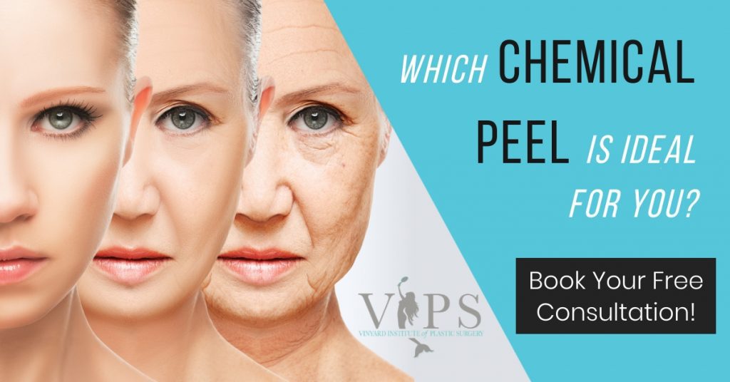 which chemical peel is ideal for you?