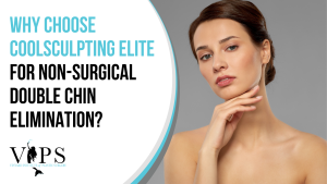 why choose coolsculpting elite for non surgical double chin elimination