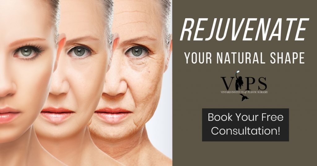 rejuvenate your natural shape