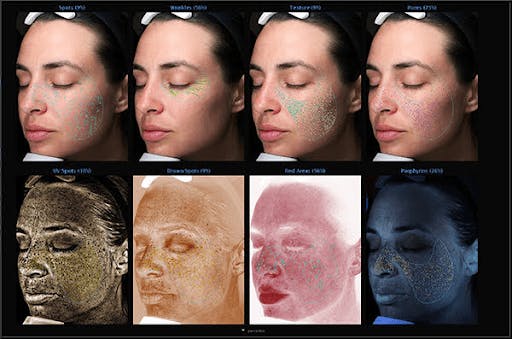 facial scan results