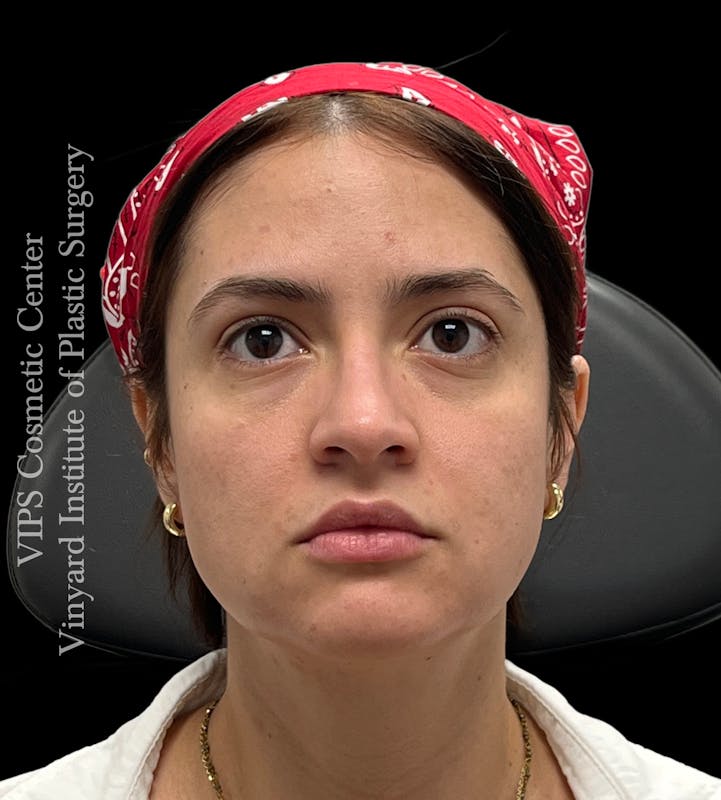 procedure6