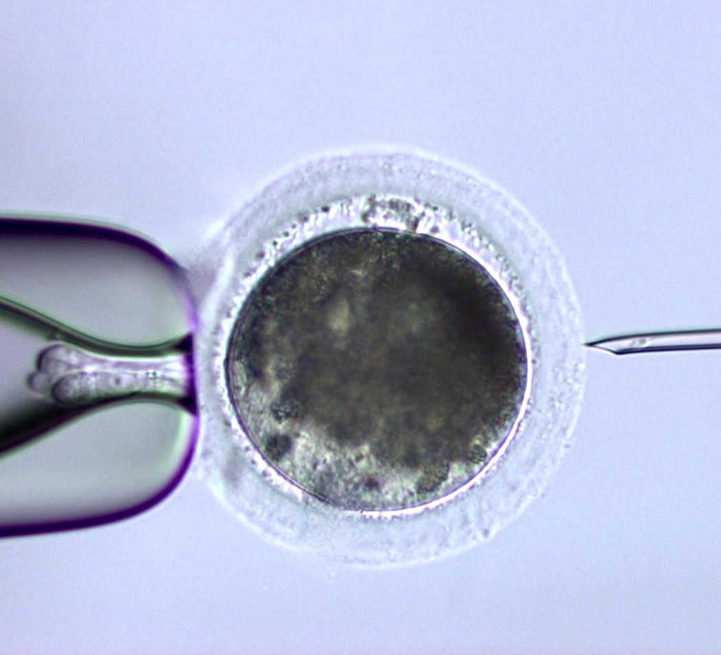 An oocyte being injected using the ICSI technique