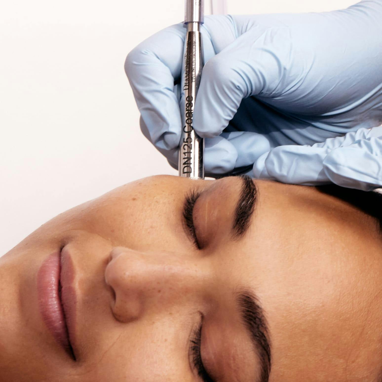 close up of a woman receiving DiamondTouch treatment on the side of her face